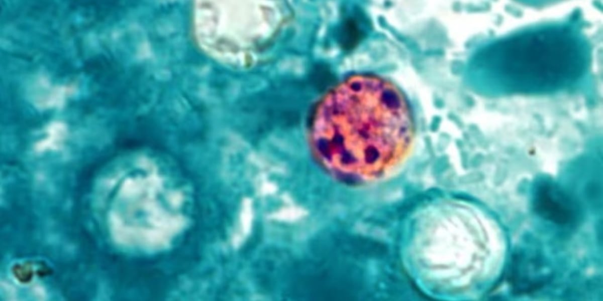 Cyclospora and Alaska: how worried should we be?